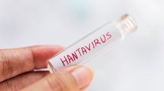 Hantavirus
